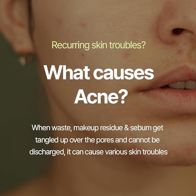 Pyunkang Yul PKY Calming Cleansing Foam, Low pH Formula Facial Wash/Cleanser with Witch Hazel, AHA for oil control- Cica, Tea Tree Extract - Rapid Moisture replenishment 3.38 Fl.oz