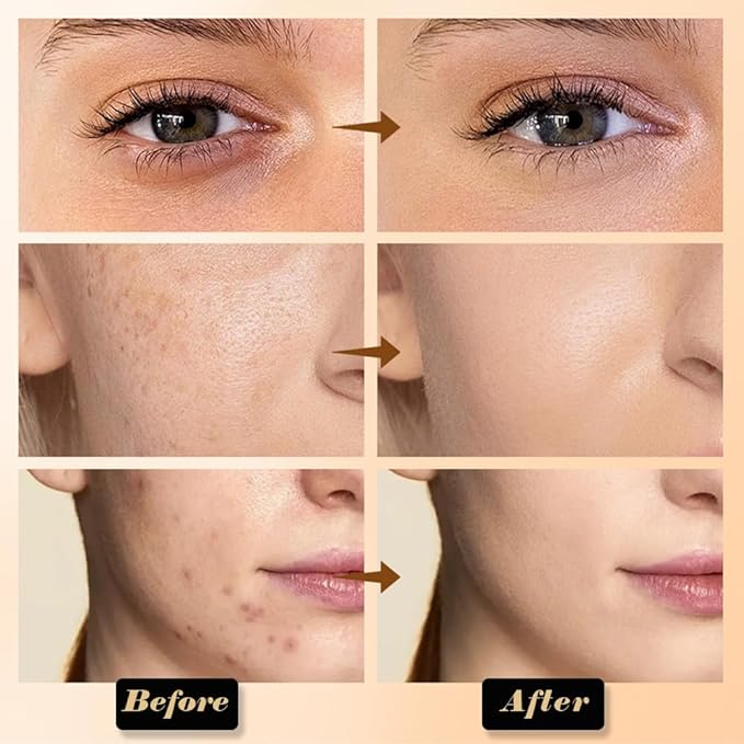 evpct 6 Colors Concealers Full Coverage Cream Contour Palette with Brush for Older Women, Under Eye Color Corrector Tri Color Pot Concealer Palette for Dark Circles Mature Skin Makeup, Waterproof, A3