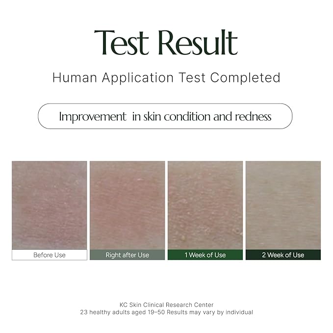 PARIS CRÈME d'AURORA EXCELLENCE – Niacinamide Brightening Cream for Even Skin Tone | Korean Skincare, 1.05 fl oz (30 ml)