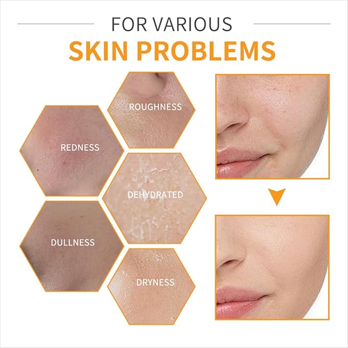 Vitamin C Skincare Set for Face - 6 Piece Kit with Cleanser, Serum, Eye Cream, Moisturizer, Sunscreen & Toner | Brightening, Hydrating & Anti-Aging | Perfect for Teens & Girls | Value Skincare Bundle