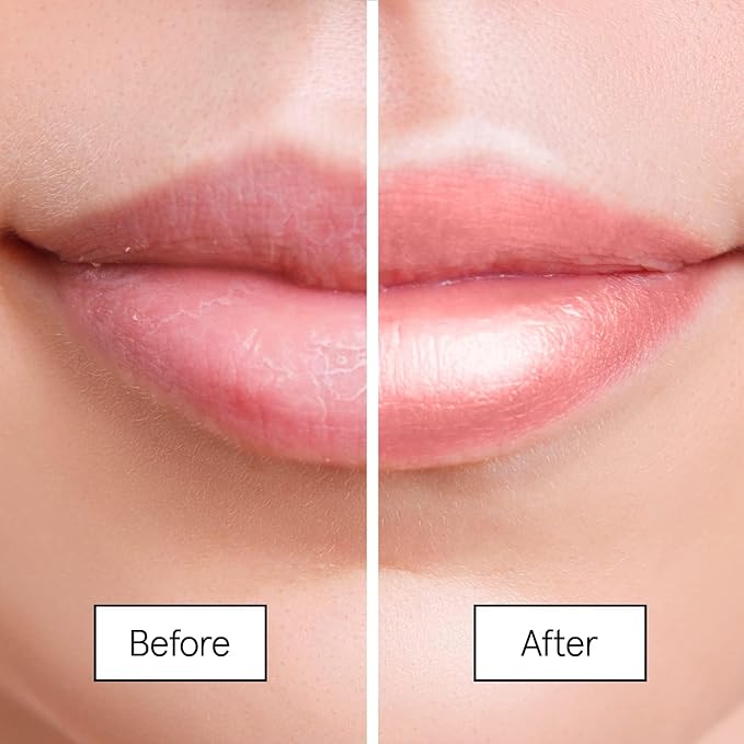 grace & stella Award Winning Lip Butter - Hydrating Lip Balm - Nourishing Lip Mask (1-pack) Travel Essentials, Travel Size Toiletries, Birthday Gifts for Women & Teens - Overnight Lip Repair - Vegan