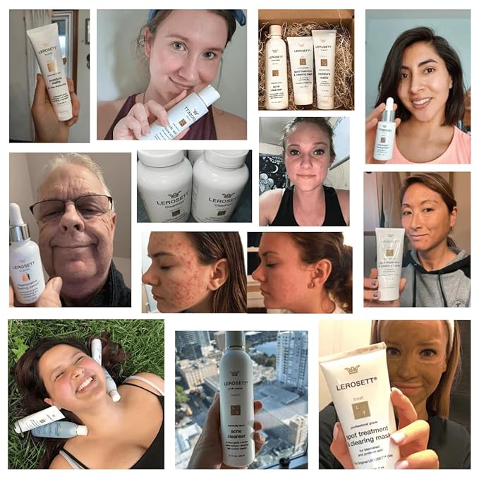 LEROSETTยฎ Clear Skin Face Wash โ Gentle Gel Cleanser with 60% Aloe-Rich Botanicals, 4% Glycolic Acid & Vit-E Microbeads โ Fights Breakouts, Unclogs Pores, Balances Oil โ Spa-Grade, Vegan โ 6.7oz