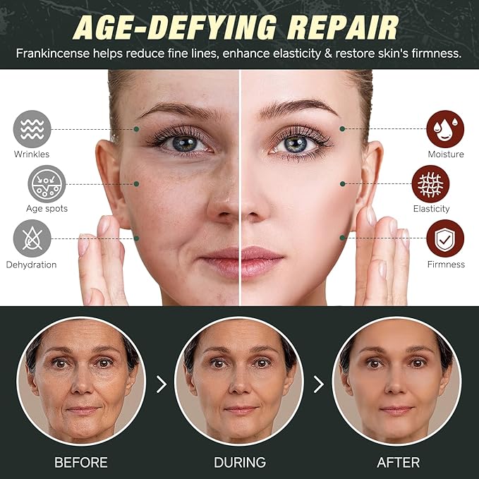 2 Pack Handmade Beef Tallow with Frankincense and Castor Oil Face Balm, 100% Grass-Fed Tallow for Skin Care, Face & Body Moisturizer for Sensitive Skin & Dry Skin Age Defying, Natural Lotion