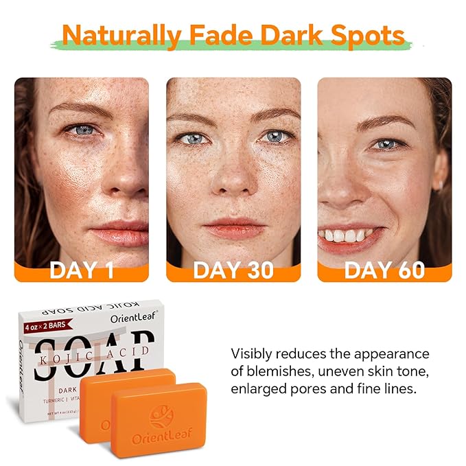 Kojic Acid Soap with African Sponge Net, 4oz Turmeric Soap Bar, Fresh Citurs Scent, Gentle for Face and Body Wash with Vitamin C, Retinol (2 Pack)