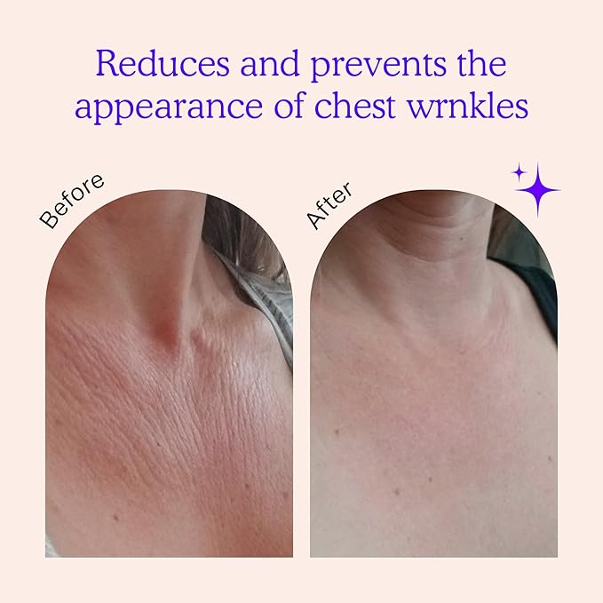 BLUMBODY Chest Wrinkle Pads – Anti-Wrinkle Silicone Patches Skin Firming, Smoothing – Reusable Overnight Chest Pads – Anti-Aging Crepe Erase Pad – Neck, Décolleté (1-Month Supply)