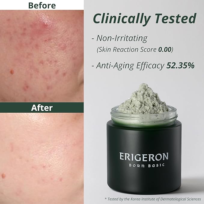 Heartleaf Facial Cleanser, Face Mask, Greek Yogurt Cleanser, Soothing, Deep Pore Scrubber & Face Wash with Green Tea, Blackhead Remover, Korean Skin Care (3.38 fl.oz.)