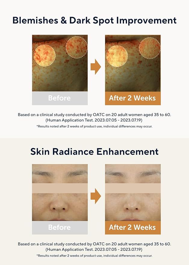 AROMATICA Glow Vita C Toning Serum Orange & Neroli - Orange Vitamin C Serum for Face with Hyaluronic Acid for Sensitive Skin (30ml/1.01 fl. oz)