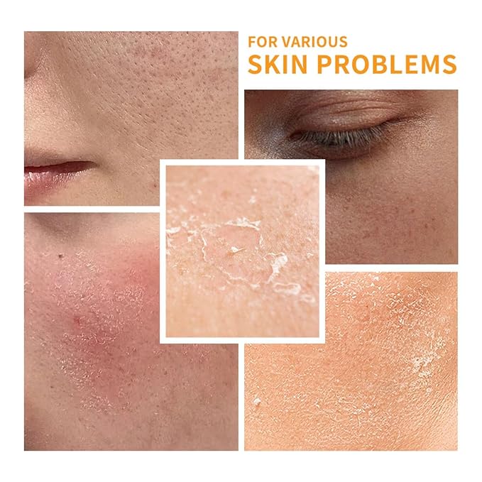 Vitamin C Skincare Set for Face - 6 Piece Kit with Cleanser, Serum, Eye Cream, Moisturizer, Sunscreen & Toner | Brightening, Hydrating & Anti-Aging | Perfect for Teens & Girls | Value Skincare Bundle