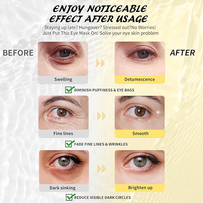 Retinol Under Eye Patches (24 Pairs), Purple Eye Masks for Dark Circles, Puffy Eyes & Wrinkles, Firming Collagen Eye Patches, Vegan Cruelty-Free Skincare Gifts for Her