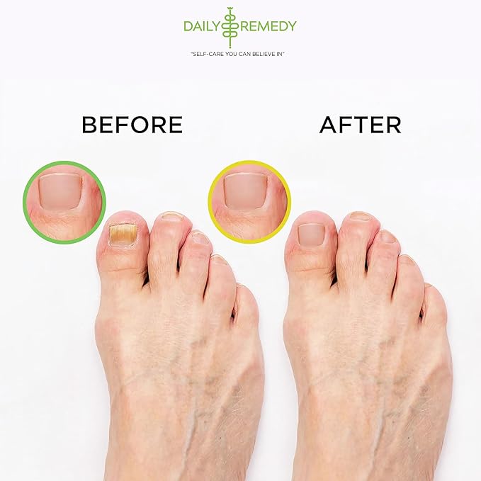 DAILY REMEDY 4-Pack Foot Soak Set - 2 Extra Strength Tea Tree Oil & 2 Citrus Detox - Made In USA - Soothes Tired Feet, Athletes Foot, Stubborn Foot Odor, Softens Calluses & Refreshes & Detoxifies