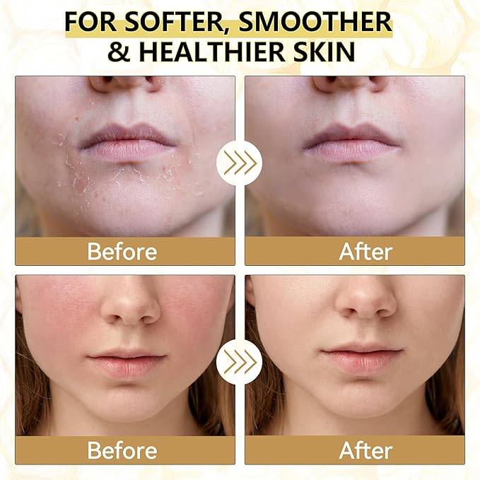 Beef Tallow for Skin, Organic Tallow and Honey Balm for Face, Natural Face Moisturizer, Grass Fed Beef Tallow Skin Care Cream Body Butter, Deep Hydrate and Nourish Dry Skin