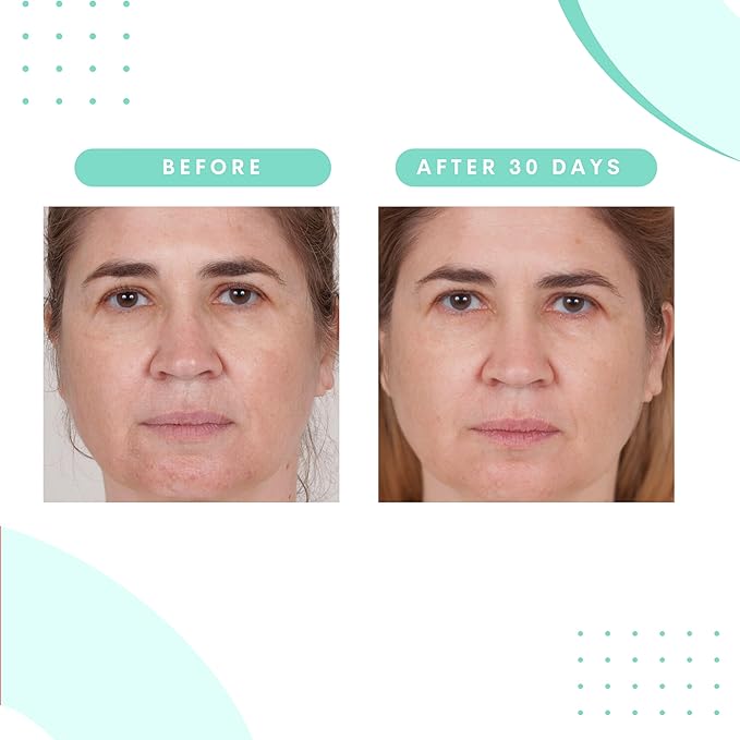 Serious Skincare Glycolic Cleanser - Daily Non-Drying Exfoliating Face Wash - 10% Glycolic Acid - Deep Pore Purifying - Removes Blackheads, Makeup & Impurities 4 Fl. Oz.