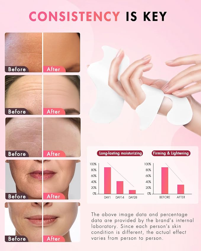 Forehead Wrinkle Patches & Smile Line Patches, Overnight Facial Wrinkle Treatment with Hyaluronic Acid, Aloe, Collagen & Vitamin E to Lift Smile Lines for Women 36pcs with Vitamin C Serum