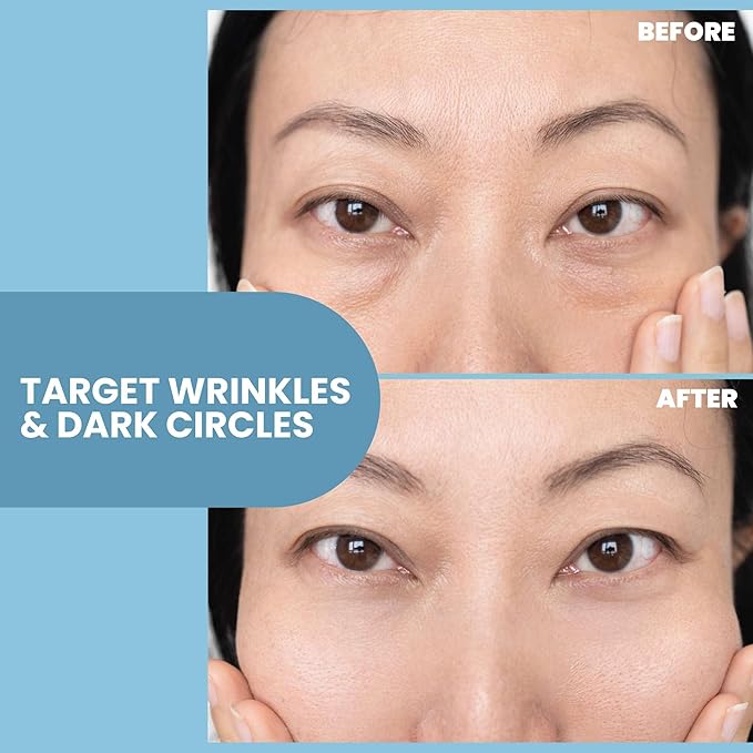 Anti-Aging Eye Gel - Luxurious Hydrating Under Eye Cream For Dark Circles and Puffiness, Bags, Crows Feet, Wrinkles - With Hyaluronic Acid & Skin-Firming Peptides Serum 2 oz (2 Pack)