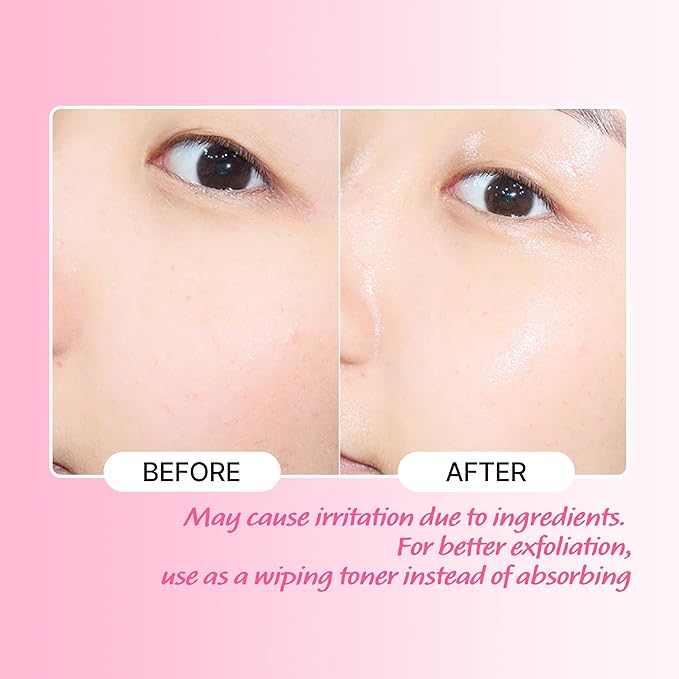 TOUCH IN SOL No Poreblem AHA BHA PHA Toner - Glycolic & Salicylic Acid Liquid Exfoliator - Makeup Prep & Pore Cleanser - Exfoliate, Soothe & Refresh Skin for Brighter Complexion