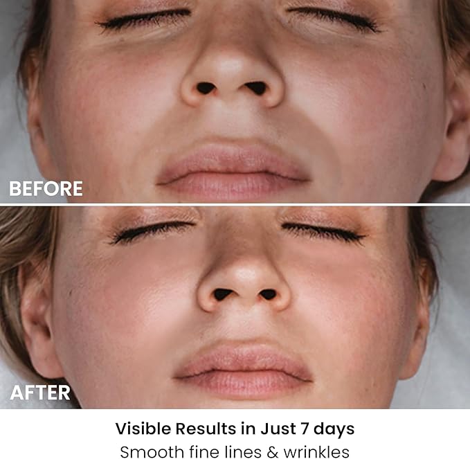 AMIRO Spectra 5-in-1 Light Therapy Face Mask, Contour With Blue, Red, Green, Yellow, and Infrared Light, 3 Modes for Oily, Acne-Prone, and Sagging Skin, Skincare for Face, Silver