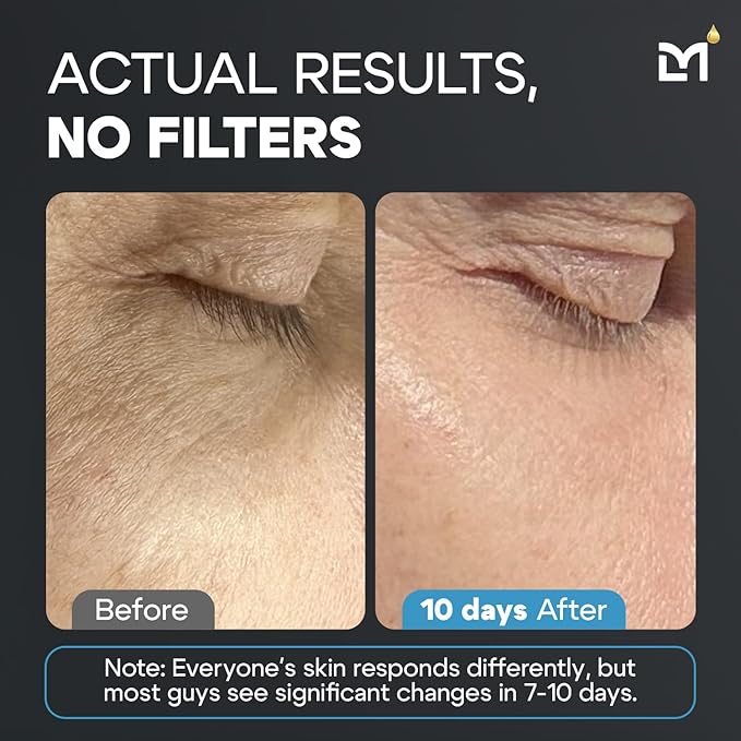 Titan Anti-Aging Mens Skin Care Kit – Cleanser, Face Serum, Mens Face Moisturizer – Men, Skin Care Set – Dark Spots, Wrinkles, Fine Lines – Vitamin C, Niacinamide, Ceramides, HA – Unscented