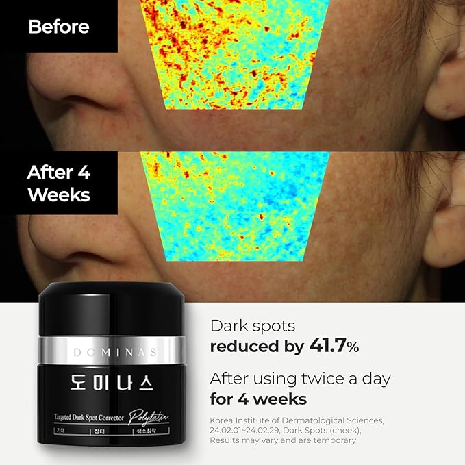 Cream Plus DOMINAS - Advanced Korean Cream for Even Skin Tone and Skin Elasticity. Niacinamide, Panthenol, Urea, Trehalose & TECA (Travel Kit, 0.7+0.35oz)