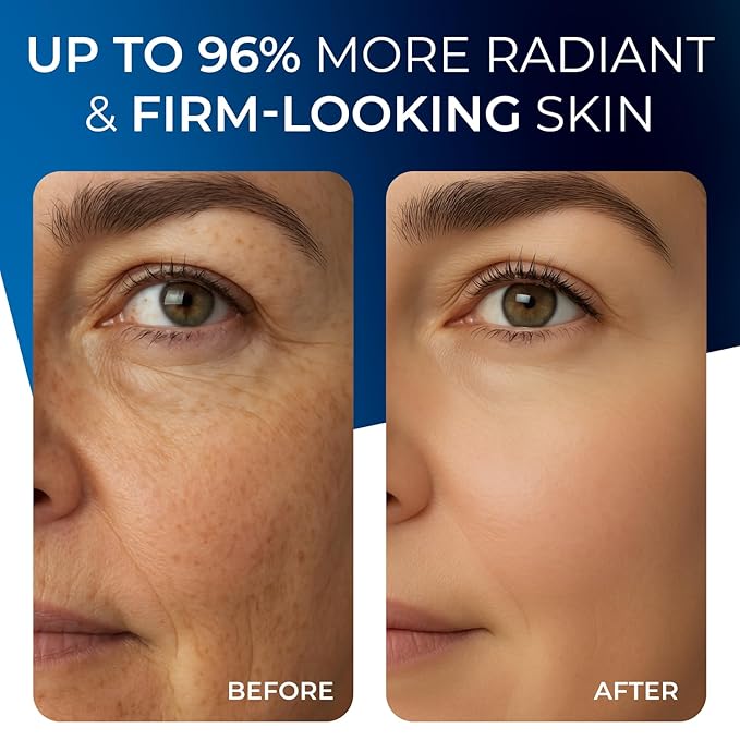 2 in 1 Retinol Moisturizer Cream, Tightening & Lifting Neck Cream, Advanced Anti-Aging Face Moisturizer, Reduces Fine Lines & Wrinkles for Neck & Face & Chest (60 ml/2 oz)