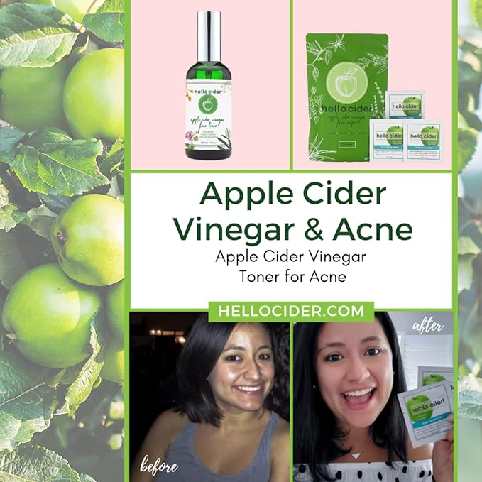 Apple Cider Vinegar Acne Face Wipes-Organic TeaTree, Rose, Chamomile, Witch Hazel.Oil free. Reduce Blemish & Acne. Tone,Restore, Sooth, Balance pH. Dry, Normal, Sensitive Skin. 25ct. USA Hello Cider