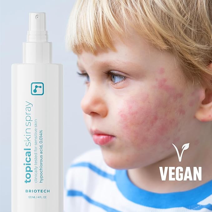 BRIOTECH Topical Skin Spray, Hypochlorous Acid for Sensitive Skin, HOCl Facial Mist, Full Body Support Against Irritation, Calm Redness, Soothe Foot & Scalp, 32 oz Refill (2 Pack)