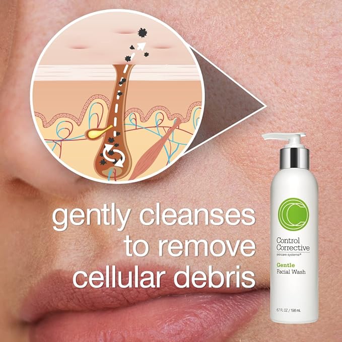 CONTROL CORRECTIVE Gentle Facial Wash, 6.7 Oz - Hydrates, Normalizes & Restores Balance, For Normal Or Combination Skin, Aloe Vera Based, Lightly Foaming Cleanser, Gel To Foam