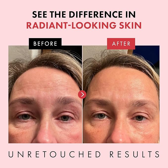 Eclat Skincare Retinol Night Cream – 2.5% Retinol & Hyaluronic Acid Face Moisturizer for Wrinkles, Fine Lines & Hydration – Firming Anti Aging Cream for Smooth, Radiant Skin 1.7 fl oz