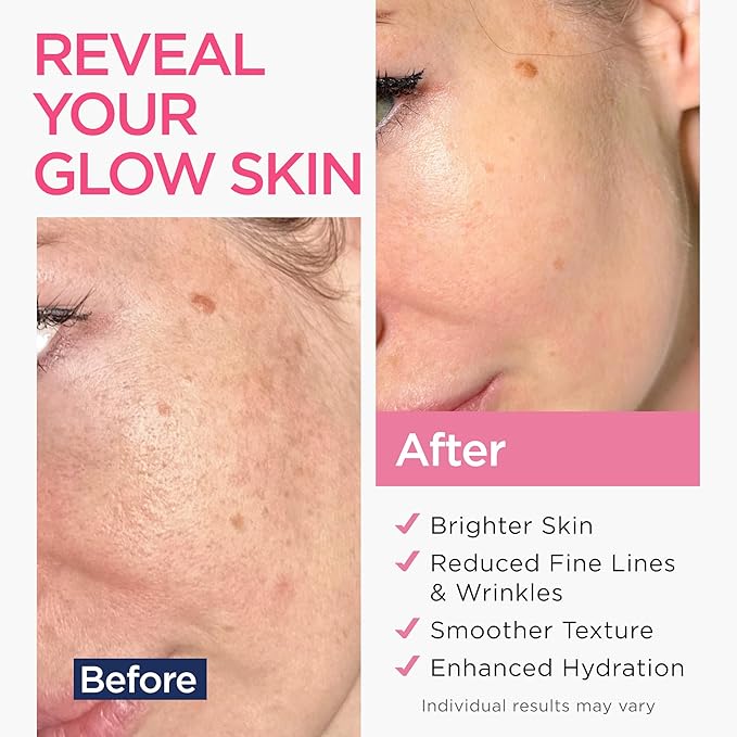 Retinol Serum for Face (8Oz) with Hyaluronic Acid, Vitamin E & Aloe Vera - Anti-Aging Serum