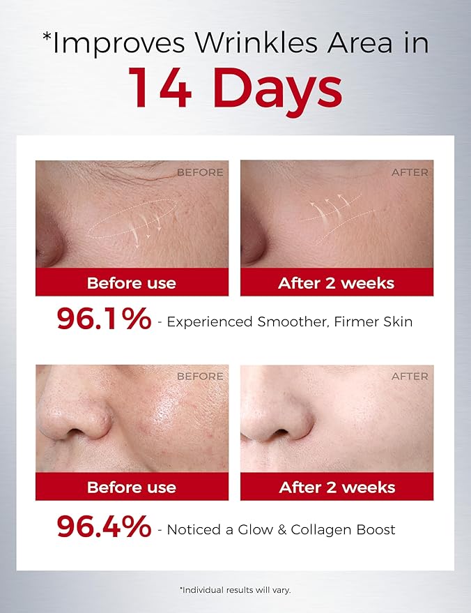 Retinol Serum for Face with 300PPM Retinol, Peptides – Firming, Anti Aging & Wrinkle Peptides Serum for Face - Korean Skincare for Smoothing & Hydrating, Ideal for Beginners|1.01 fl.oz