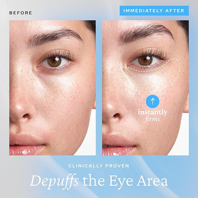 belif Aqua Bomb Cooling Eye Gel - Caffeine & Hyaluronic Acid for Puffiness & Hydration, Niacinamide & Vitamin C for Dark Circles, Adenosine & Collagen for Plumping & Firming, Korean Skin Care