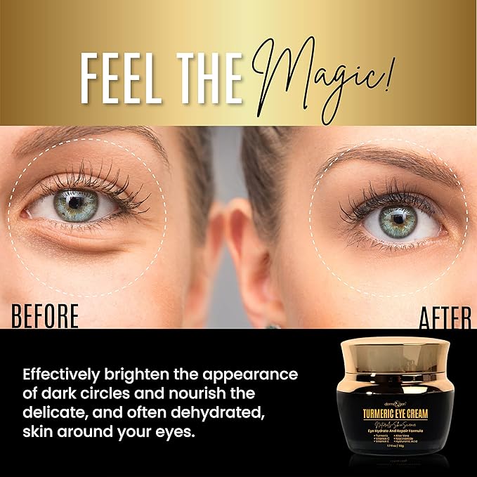 Vitamin C + Turmeric Eye Cream for Dark Circles & Puffiness - Hydrating & Moisturizing Under Eye Cream for Fine Lines & Bags - Reduce Dark Spots and Wrinkles for a Fresh Look - 1.7 FL OZ