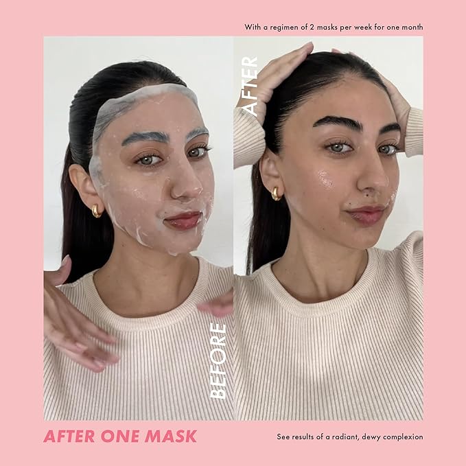 ESW Beauty Most Loved Face Masks - 5-Pack Skincare Set - Hydrating, Soothing & Calming - Includes Strawberries & Cream, Deep Detox, The Pink Dream, Vanilla Oat & Green Reset