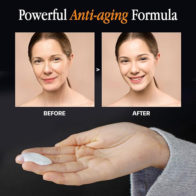 Triple Lipid-Peptide Cream: Enriched with Lipids, Ceramides, Peptides, Hyaluronic Acid, and Fatty Acid for Firming, Anti-Aging and Plumping Face Moisturizer (53 ml /1.8 fl oz)