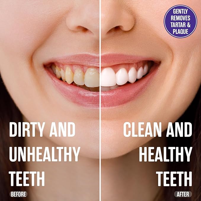 SprinJene Fluoride Free Toothpaste - Patented Natural Toothpaste with Black Seed Oil & Zinc - Made in The USA - Vegan Non Fluoride for Fresh Breath Preservative Free (1 Pack)