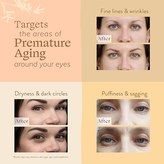 LILY SADO MILK+MANUKAโข Eye Repair Cream - Anti-Aging Natural Gentle Formula w/Coconut Milk, Manuka Honey, Sodium Hyaluronate & VITS C, B5 & E - Prevents Puffiness, Under-eye Wrinkles & Eye Bags - 1oz