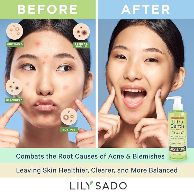 LILY SADO TEA+Cβ’ Green Tea & Vitamin C Face Cleanser β Natural Vegan Antioxidant Daily Face Wash with Aloe, Rosehip, Meadowfoam - Gentle Deep Cleansing for Acne, Blackheads, Blemishes. 8 oz