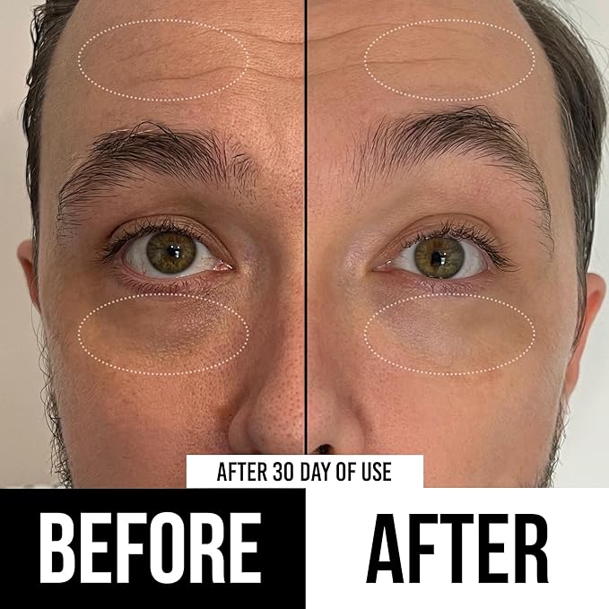 RUGGED & DAPPER Premium Men's Eye Cream | Age Defense for Dark Circles, Wrinkles & Puffy Eyes | Unscented | Hyaluronic Acid, Aloe + Argan Oil