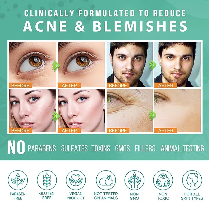 LILY SADO TEA+Cβ’ Green Tea & Vitamin C Face Cleanser β Natural Vegan Antioxidant Daily Face Wash with Aloe, Rosehip, Meadowfoam - Gentle Deep Cleansing for Acne, Blackheads, Blemishes. 8 oz