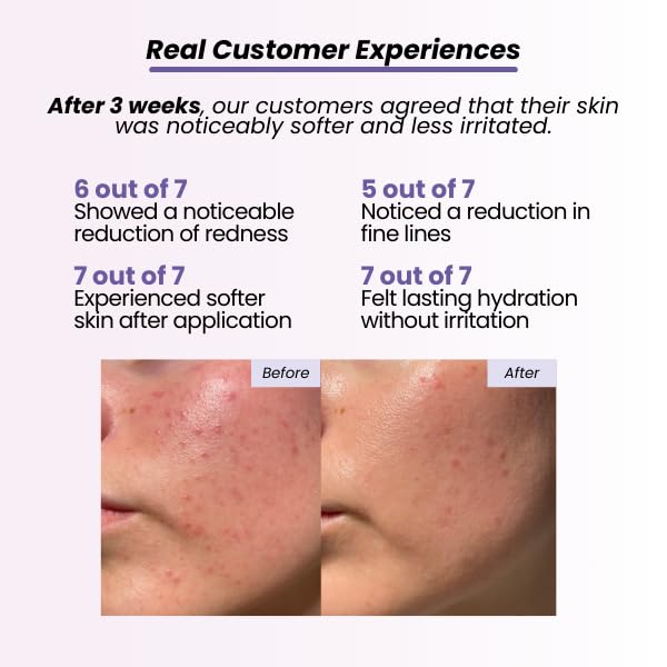 Nourishing Night Cream for Dry & Sensitive Skin, Dermatologist Tested, Soothing Face Moisturizer, Fragrance-Free, Non-Comedogenic, Barrier-Repair