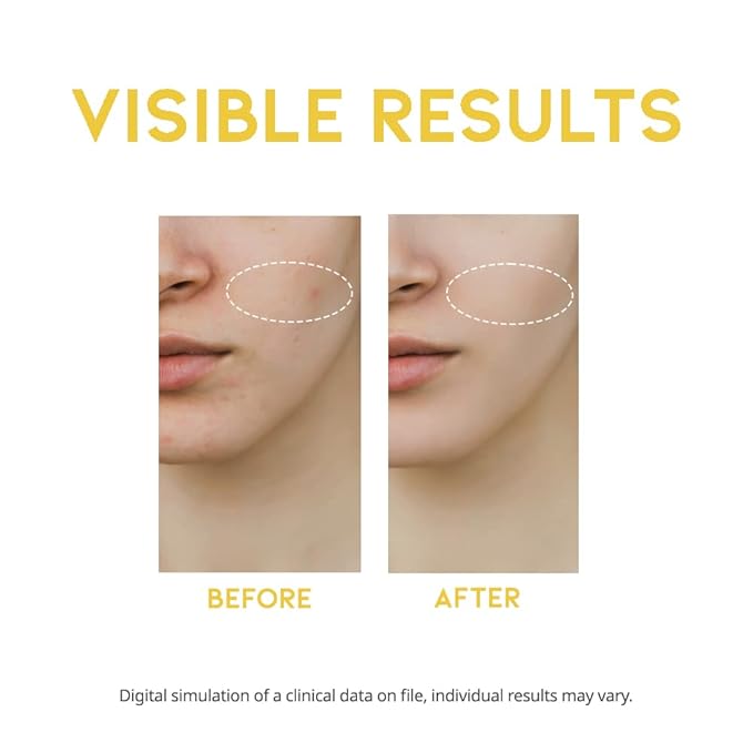 Vitamin C Serum for Face Korean, Brightening, Ascorbic acid, Vitamin Tree Water 1.69 Fl Oz