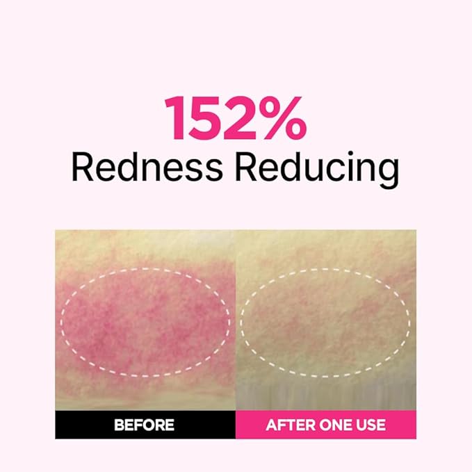 ISOI Blemish Care Up Facial Serum Triple Set, Korean Skin Care Set for Glass Skin Radiance, 2 Full Size & 1 Refill, Eye & Wrinkle Patch Tester, Daily Hydration Skincare Gift for Women (2.13 fl. oz)