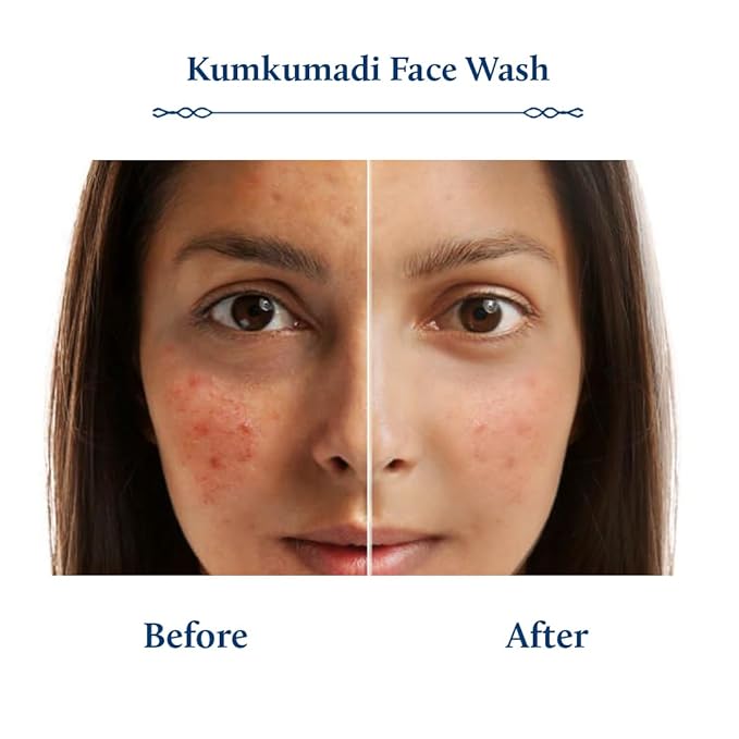 Blue Nectar Kumkumadi Brightening Face Wash with Saffron for Women & Men | Sulphate free Anti Pimple Face Cleanser (10 Herbs, 3.38 Fl Oz)