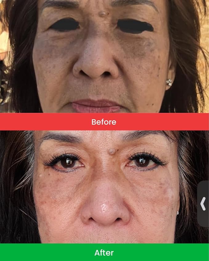 Brightening Facial Serum has Vitamin C, Niacinamide, Retinoate, Vitamine E, and Natural Ingredients help Reduce Dark Spots & Hyperpimentation, Smooth & Evens Skin Tone, Reduces Fine Lines.