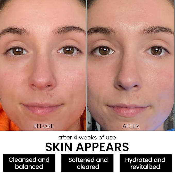 Kleem Organics Pro-Collagen Glycolic Acid Face Wash with Salicylic Acid - Organic Face Cleanser for Women & Men to Unclog Pores & Improve Skin Tone and Texture - Gentle Exfoliating Face Wash - 4.05 oz