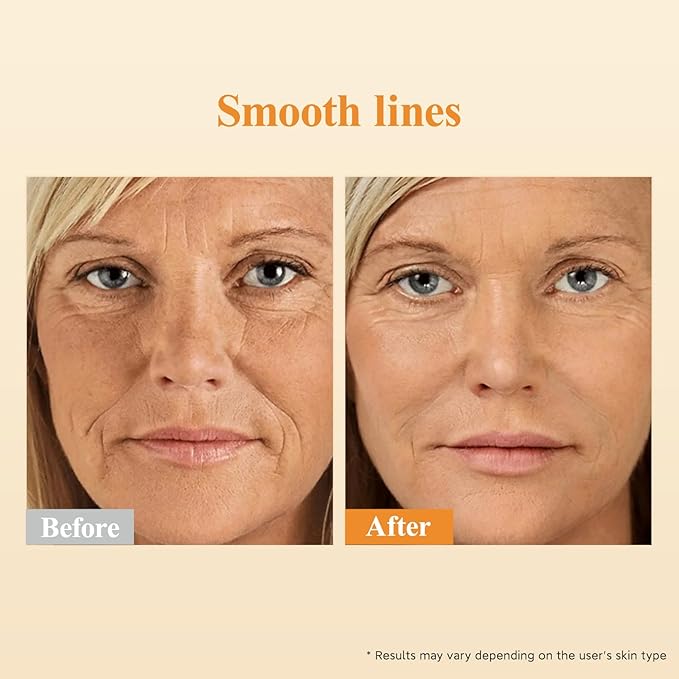 HKH Retinol + HPR Serum for Face - Anti-Aging Wrinkle Night Retinol Capsules, Peptide Serum for Women, Reduce Fine Lines, Tighten Sagging Skin, Fragrance-Free, Alcohol-Free & Non-Greasy