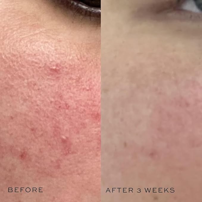 DIME Beauty Super Skin Toner, Alcohol-Free Witch Hazel Toner, Hydrating for Face with Aloe Vera and Cucumber Extract, 4 oz / 120 ml