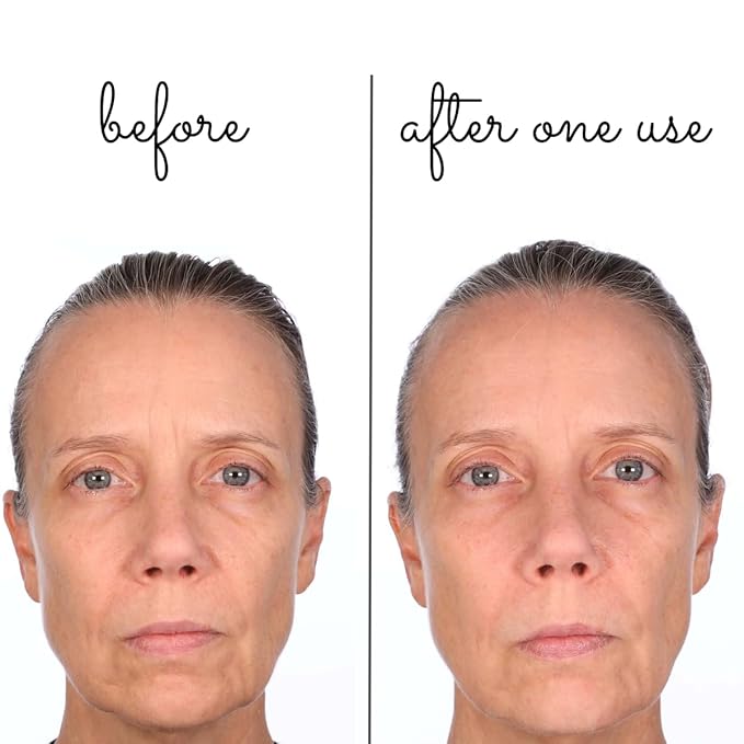 Consult Beaute Volumagen Miracle Plumping Barrier Balm - Facial Moisture Slugging - Overnight Deep Skin Hydration - Dry Skin - Hyaluronic Acid - Petrolatum Free - Lanolin Free - Mineral Oil Free 1 oz