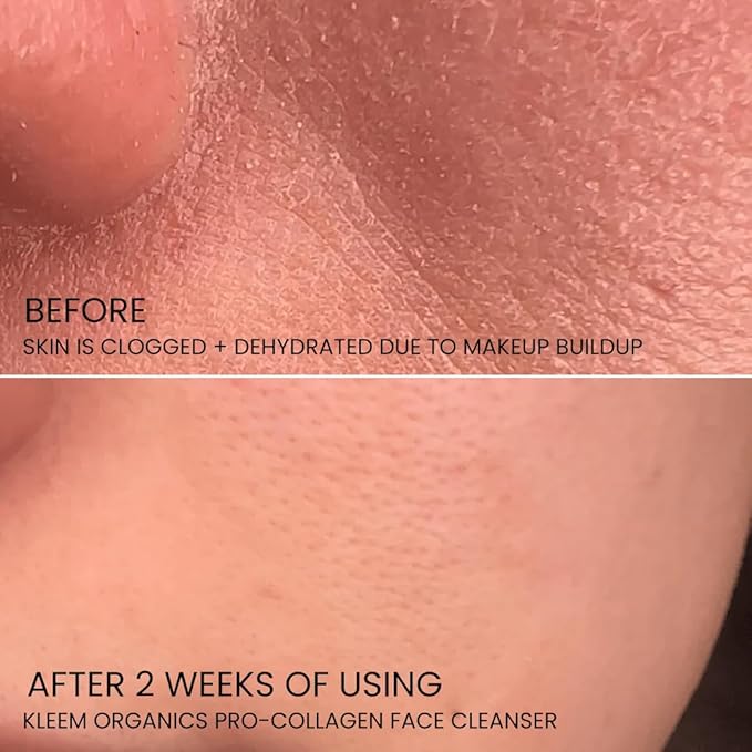 Kleem Organics Pro-Collagen Glycolic Acid Face Wash with Salicylic Acid - Organic Face Cleanser for Women & Men to Unclog Pores & Improve Skin Tone and Texture - Gentle Exfoliating Face Wash - 4.05 oz