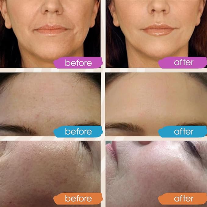 GLEOW Retinol Serum for Face, Vitamin C with Hyaluronic Acid Face Serum for Women and Men, Glow Skin Care Set Total Package Targets Appearance of Uneven Skin Tone and Dryness 3x1oz