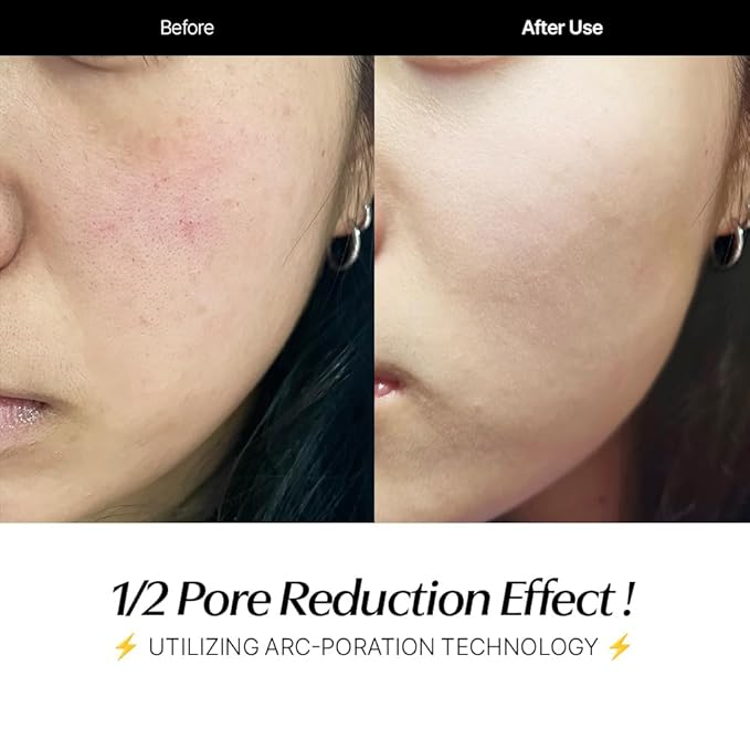 CELORABY Potension Penta-Shot Glass Skin Glow Booster | 5-in-1 Korean Skincare Device for Pore Minimizing, Black Head Care, Enhanced Absorption & Needle-Free Professional Treatment at Home